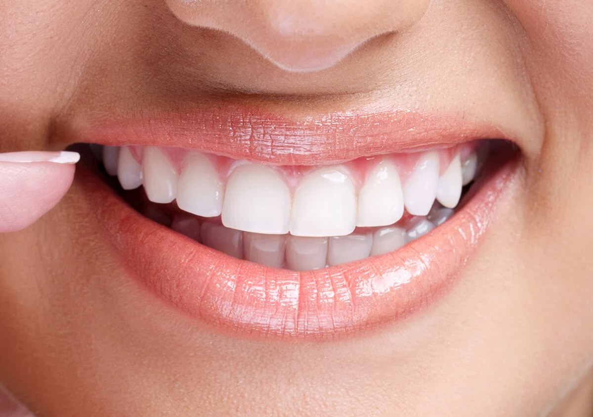 Close-up of a woman’s bright, even smile