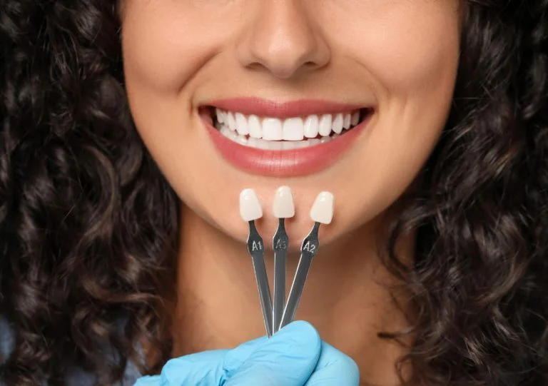 Tooth shade guide held beside a woman’s smile to match veneer color